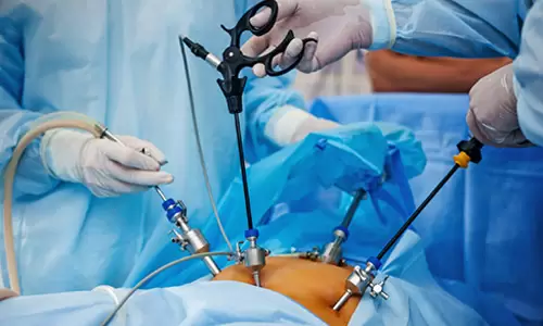 آموزش تجهیزات لاپراسکوپی