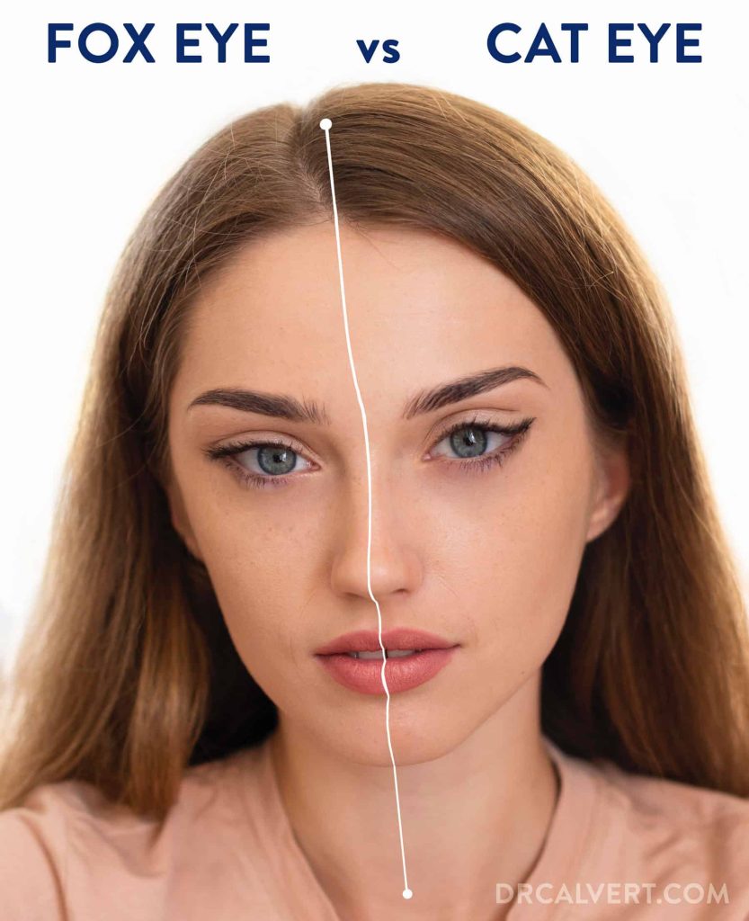 تفاوت چشم روباهی و گربه ای